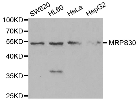 MRPS30 Antibody - Western blot analysis of extracts of various cell lines.