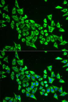 MRPS30 Antibody - Immunofluorescence analysis of HeLa cells.