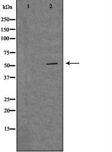 MRPS30 Antibody - Western blot analysis of extracts of LOVO cells using MRPS30 antibody. The lane on the left is treated with the antigen-specific peptide.