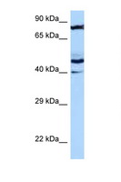 MRPS31 Antibody - MRPS31 antibody Western blot of HT1080 Cell lysate. Antibody concentration 1 ug/ml.  This image was taken for the unconjugated form of this product. Other forms have not been tested.