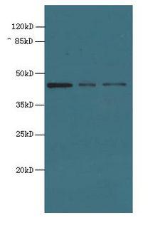 MRPS31 Antibody - Western blot. All lanes: MRPS31 antibody at 8 ug/ml. Lane 1: HeLa whole cell lysate. Lane 2: MCF7 whole cell lysate. Lane 3: Jurkat whole cell lysate. Secondary Goat polyclonal to Rabbit IgG at 1:10000 dilution. Predicted band size: 45 kDa. Observed band size: 45 kDa.