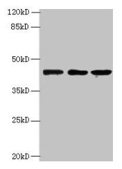 MRPS31 Antibody - Western blot All lanes: MRPS31 antibody at 8µg/ml Lane 1: Hela whole cell lysate Lane 2: MCF-7 whole cell lysate Lane 3: Jurkat whole cell lysate Secondary Goat polyclonal to rabbit IgG at 1/10000 dilution Predicted band size: 46 kDa Observed band size: 46 kDa