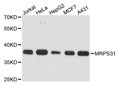 MRPS31 Antibody - Western blot analysis of extracts of various cell lines, using MRPS31 antibody at 1:3000 dilution. The secondary antibody used was an HRP Goat Anti-Rabbit IgG (H+L) at 1:10000 dilution. Lysates were loaded 25ug per lane and 3% nonfat dry milk in TBST was used for blocking. An ECL Kit was used for detection and the exposure time was 30s.
