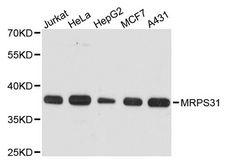 MRPS31 Antibody - Western blot analysis of extracts of various cell lines, using MRPS31 antibody at 1:3000 dilution. The secondary antibody used was an HRP Goat Anti-Rabbit IgG (H+L) at 1:10000 dilution. Lysates were loaded 25ug per lane and 3% nonfat dry milk in TBST was used for blocking. An ECL Kit was used for detection and the exposure time was 30s.