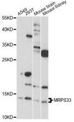 MRPS33 Antibody - Western blot analysis of extracts of various cell lines, using MRPS33 antibody at 1:1000 dilution. The secondary antibody used was an HRP Goat Anti-Rabbit IgG (H+L) at 1:10000 dilution. Lysates were loaded 25ug per lane and 3% nonfat dry milk in TBST was used for blocking. An ECL Kit was used for detection and the exposure time was 90s.
