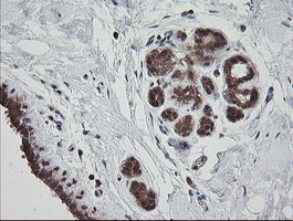 MRPS34 Antibody - IHC of paraffin-embedded Human breast tissue using anti-MRPS34 mouse monoclonal antibody.