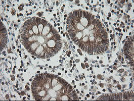 MRPS34 Antibody - IHC of paraffin-embedded Human colon tissue using anti-MRPS34 mouse monoclonal antibody.