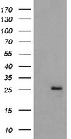 MRPS34 Antibody - HEK293T cells were transfected with the pCMV6-ENTRY control (Left lane) or pCMV6-ENTRY MRPS34 (Right lane) cDNA for 48 hrs and lysed. Equivalent amounts of cell lysates (5 ug per lane) were separated by SDS-PAGE and immunoblotted with anti-MRPS34.