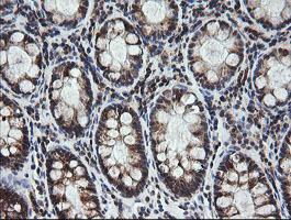 MRPS34 Antibody - IHC of paraffin-embedded Human colon tissue using anti-MRPS34 mouse monoclonal antibody.