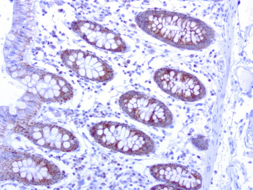 MRPS34 Antibody - Immunohistochemical staining of paraffin-embedded human colon normal adjacent using anti-MRPS34 clone UMAB125 mouse monoclonal antibody at 1:200 dilution 1mg/mL and detection with Polink2 Broad HRP DAB.requires heat-induced epitope retrieval with citrate pH6.0 in a presure cooker for 3 minutes at 110C. The image shows membranous and cytoplasmic staining in the normal epithelia cells.
