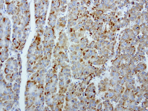 MRPS34 Antibody - Immunohistochemical staining of paraffin-embedded human liver normal adjacent using anti-MRPS34 clone UMAB125 mouse monoclonal antibody at 1:200 dilution 1mg/mL and detection with Polink2 Broad HRP DAB.requires heat-induced epitope retrieval with citrate pH6.0 in a presure cooker for 3 minutes at 110C. The image shows membranous and puntate cytoplasmic staining in hepatocyte cells