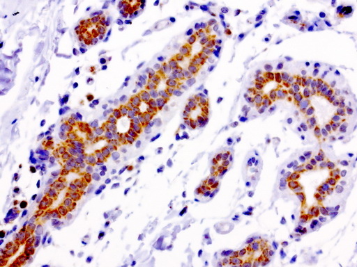 MRPS34 Antibody - Immunohistochemical staining of paraffin-embedded human breast normal adjacent using anti-MRPS34 clone UMAB125 mouse monoclonal antibody at 1:200 dilution 1mg/mL and detection with Polink2 Broad HRP DAB.requires heat-induced epitope retrieval with citrate pH6.0 in a presure cooker for 3 minutes at 110C. The image shows membranous and cytoplasmic staining in breast epithelia cells.