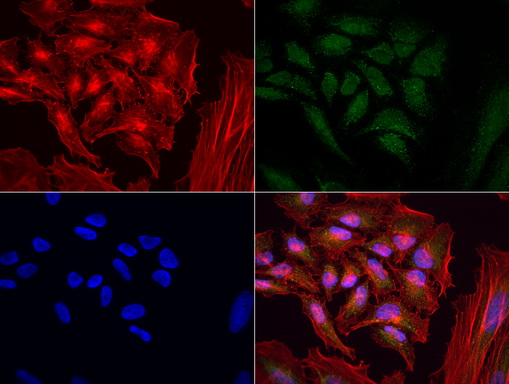 MRPS34 Antibody - Immunofluorescent staining of HeLa cells using anti-MRPS34 mouse monoclonal antibody  green, 1:100). Actin filaments were labeled with Alexa Fluor® 594 Phalloidin. (red), and nuclear with DAPI. (blue).