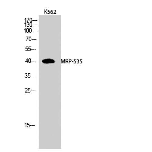 MRPS35 Antibody - Western blot of MRP-S35 antibody
