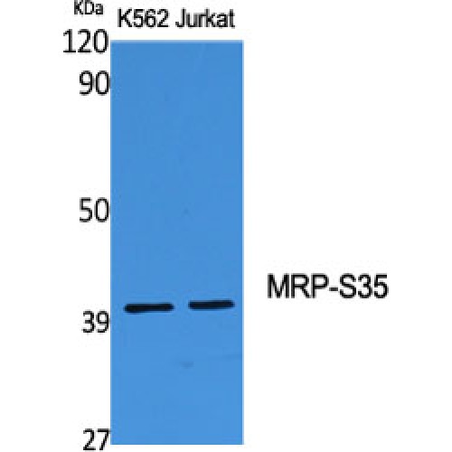 MRPS35 Antibody - Western blot of MRP-S35 antibody