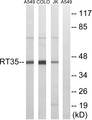 MRPS35 Antibody - Western blot analysis of lysates from Jurkat, COLO, and A549 cells, using MRPS35 Antibody. The lane on the right is blocked with the synthesized peptide.