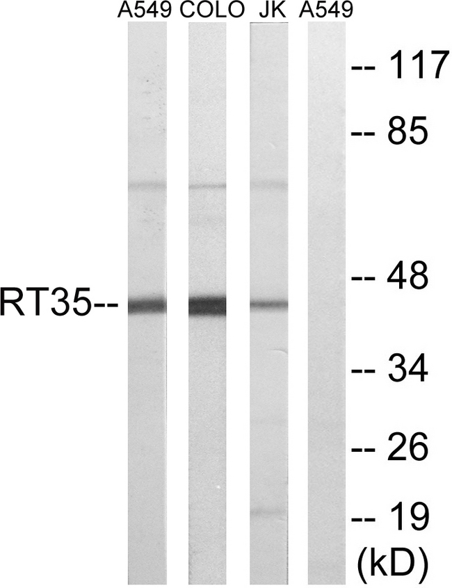 MRPS35 Antibody - Western blot analysis of lysates from Jurkat, COLO, and A549 cells, using MRPS35 Antibody. The lane on the right is blocked with the synthesized peptide.