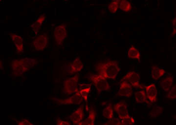 MRPS35 Antibody - Staining HeLa cells by IF/ICC. The samples were fixed with PFA and permeabilized in 0.1% Triton X-100, then blocked in 10% serum for 45 min at 25°C. The primary antibody was diluted at 1:200 and incubated with the sample for 1 hour at 37°C. An Alexa Fluor 594 conjugated goat anti-rabbit IgG (H+L) Ab, diluted at 1/600, was used as the secondary antibody.
