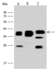 MRPS35 Antibody - Anti-MRPS35 rabbit polyclonal antibody at 1:500 dilution. Lane A: Hela Whole Cell Lysate. Lane B: A549 Whole Cell Lysate. Lane C: Jurkat Whole Cell Lysate. Lysates/proteins at 30 ug per lane. Secondary: Goat Anti-Rabbit IgG (H+L)/HRP at 1/10000 dilution. Developed using the ECL technique. Performed under reducing conditions. Predicted band size: 37 kDa. Observed band size: 37 kDa.