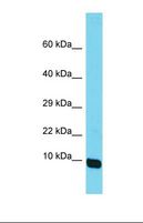 MRPS36 Antibody - Western blot of Human Hela. MRPS36 antibody dilution 1.0 ug/ml.  This image was taken for the unconjugated form of this product. Other forms have not been tested.