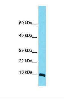 MRPS36 Antibody - Western blot of Human Hela. MRPS36 antibody dilution 1.0 ug/ml.  This image was taken for the unconjugated form of this product. Other forms have not been tested.