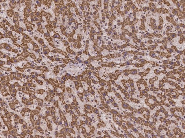 MRPS36 Antibody - Immunochemical staining of human MRPS36 in human liver with rabbit polyclonal antibody at 1:100 dilution, formalin-fixed paraffin embedded sections.