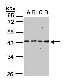 MRPS5 Antibody - Sample (30 ug whole cell lysate). A: A431, B: H1299, C: HeLa S3, D: Hep G2 . 10% SDS PAGE. MRPS5 antibody diluted at 1:1000