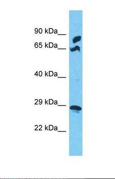 MRPS5 Antibody - Western blot of Human COLO205. MRPS5 antibody dilution 1.0 ug/ml.  This image was taken for the unconjugated form of this product. Other forms have not been tested.
