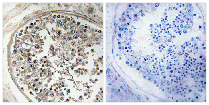 MRPS5 Antibody - Immunohistochemistry analysis of paraffin-embedded human testis, using MRPS5 Antibody. The picture on the right is blocked with the synthesized peptide.