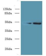MRPS5 Antibody - Western blot. All lanes: MRPS5 antibody at 5 ug/ml. Lane 1: HeLa whole cell lysate. Lane 2: Jurkat whole cell lysate. Secondary antibody: Goat polyclonal to Rabbit IgG at 1:10000 dilution. Predicted band size: 48 kDa. Observed band size: 48 kDa.