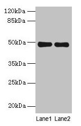 MRPS5 Antibody - Western blot All lanes: MRPS5 antibody at 5µg/ml Lane 1: Hela whole cell lysate Lane 2: Jurkat whole cell lysate Secondary Goat polyclonal to rabbit IgG at 1/10000 dilution Predicted band size: 49, 28 kDa Observed band size: 49 kDa