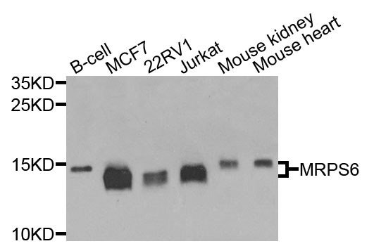 MRPS6 / MRP S6 Antibody - Western blot analysis of extracts of various cells.