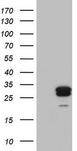 MRPS7 Antibody - HEK293T cells were transfected with the pCMV6-ENTRY control (Left lane) or pCMV6-ENTRY MRPS7 (Right lane) cDNA for 48 hrs and lysed. Equivalent amounts of cell lysates (5 ug per lane) were separated by SDS-PAGE and immunoblotted with anti-MRPS7.