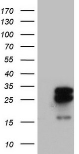MRPS7 Antibody - HEK293T cells were transfected with the pCMV6-ENTRY control (Left lane) or pCMV6-ENTRY MRPS7 (Right lane) cDNA for 48 hrs and lysed. Equivalent amounts of cell lysates (5 ug per lane) were separated by SDS-PAGE and immunoblotted with anti-MRPS7.