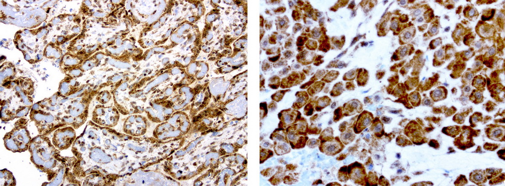MRPS7 Antibody - Immunohistochemical staining of paraffin-embedded human composit of placenta using anti-MRPS7 clone UMAB156 mouse monoclonal antibody at 1:200 dilution 1mg/mL and detection with Polink2 Broad HRP DAB.requires heat-induced epitope retrieval with citrate pH6.0 in a presure cooker for 3 minutes at 110C. The image shows membranous and cytoplasmic staining in trophoblast cells.