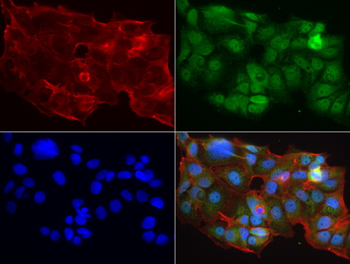 MRPS7 Antibody - Immunofluorescent staining of MCF-7 cells using anti-MRPS7 mouse monoclonal antibody  green, 1:50). Actin filaments were labeled with Alexa Fluor® 594 Phalloidin. (red), and nuclear with DAPI. (blue).