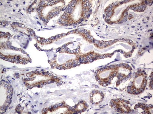 MRPS7 Antibody - Immunohistochemical staining of paraffin-embedded Human prostate tissue using anti-MRPS7 mouse monoclonal antibody.  heat-induced epitope retrieval by 1 mM EDTA in 10mM Tris, pH9.0, 120C for 3min)