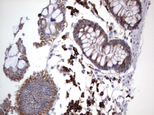 MRPS7 Antibody - Immunohistochemical staining of paraffin-embedded Human colon tissue using anti-MRPS7 mouse monoclonal antibody.  heat-induced epitope retrieval by 1 mM EDTA in 10mM Tris, pH9.0, 120C for 3min)