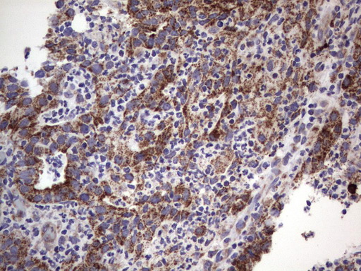MRPS7 Antibody - Immunohistochemical staining of paraffin-embedded Human lymph node tissue using anti-MRPS7 mouse monoclonal antibody.  heat-induced epitope retrieval by 1 mM EDTA in 10mM Tris, pH9.0, 120C for 3min)