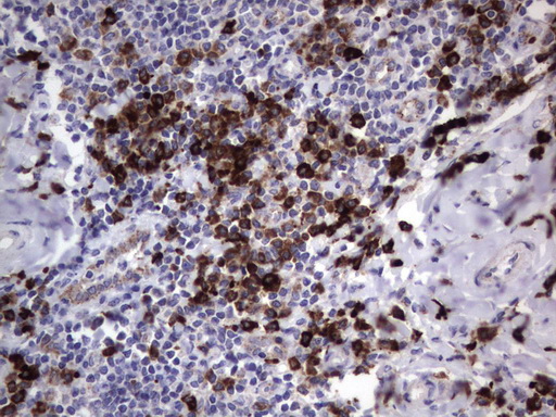 MRPS7 Antibody - Immunohistochemical staining of paraffin-embedded Human tonsil using anti-MRPS7 mouse monoclonal antibody.  heat-induced epitope retrieval by 1 mM EDTA in 10mM Tris, pH9.0, 120C for 3min)