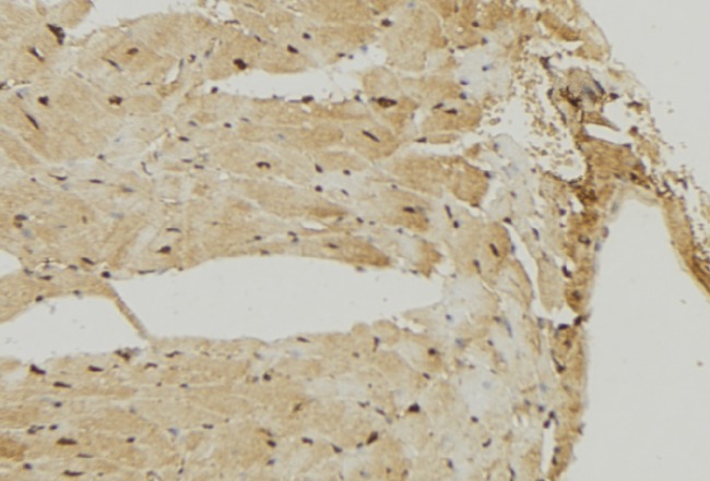 MRPS7 Antibody - 1:100 staining mouse muscle tissue by IHC-P. The sample was formaldehyde fixed and a heat mediated antigen retrieval step in citrate buffer was performed. The sample was then blocked and incubated with the antibody for 1.5 hours at 22°C. An HRP conjugated goat anti-rabbit antibody was used as the secondary.