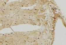 MRPS7 Antibody - 1:100 staining mouse muscle tissue by IHC-P. The sample was formaldehyde fixed and a heat mediated antigen retrieval step in citrate buffer was performed. The sample was then blocked and incubated with the antibody for 1.5 hours at 22°C. An HRP conjugated goat anti-rabbit antibody was used as the secondary.