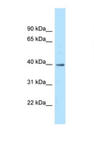 MRPS9 Antibody - MRPS9 antibody Western blot of Fetal Heart lysate. Antibody concentration 1 ug/ml.  This image was taken for the unconjugated form of this product. Other forms have not been tested.