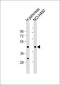 MRPS9 Antibody - All lanes: Anti-MRPS9 Antibody at 1:1000 dilution. Lane 1: human pancreas lysate. Lane 2: NCI-H460 whole cell lysate Lysates/proteins at 20 ug per lane. Secondary Goat Anti-Rabbit IgG, (H+L), Peroxidase conjugated at 1:10000 dilution. Predicted band size: 46 kDa. Blocking/Dilution buffer: 5% NFDM/TBST.