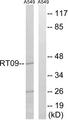 MRPS9 Antibody - Western blot analysis of extracts from A549 cells, using MRPS9 antibody.