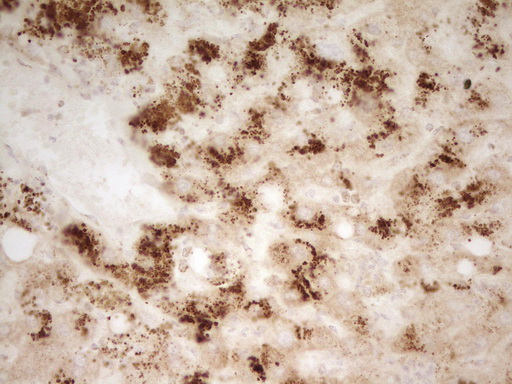 MRRF Antibody - IHC of paraffin-embedded Human liver tissue using anti-MRRF mouse monoclonal antibody. (Heat-induced epitope retrieval by 1 mM EDTA in 10mM Tris, pH8.5, 120°C for 3min).