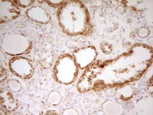 MRRF Antibody - Immunohistochemical staining of paraffin-embedded Human Kidney tissue within the normal limits using anti-MRRF mouse monoclonal antibody. (Heat-induced epitope retrieval by 1 mM EDTA in 10mM Tris, pH8.5, 120C for 3min,