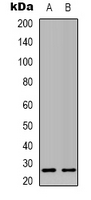 MRRF Antibody - Western blot analysis of MRRF expression in 293T (A); NIH3T3 (B) whole cell lysates.