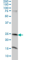 MRRF Antibody - MRRF monoclonal antibody (M01), clone 1D3 Western blot of MRRF expression in A-431.