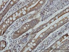 MRRF Antibody - Immunoperoxidase of monoclonal antibody to MRRF on formalin-fixed paraffin-embedded human small Intestine. [antibody concentration 3 ug/ml]